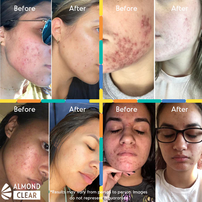 A clearing serum designed to calm folliculitis and ingrown hair irritation