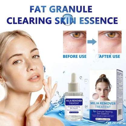 Helps Reduce Milia and Smooth Tiny White Bumps for Clearer Skin