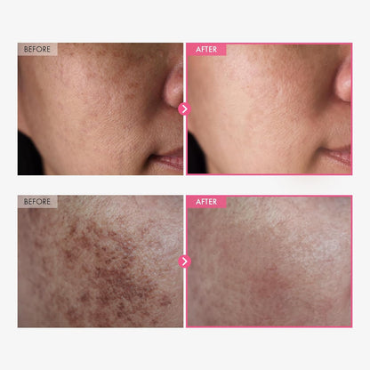 Korean Skin Care Brightening Cream