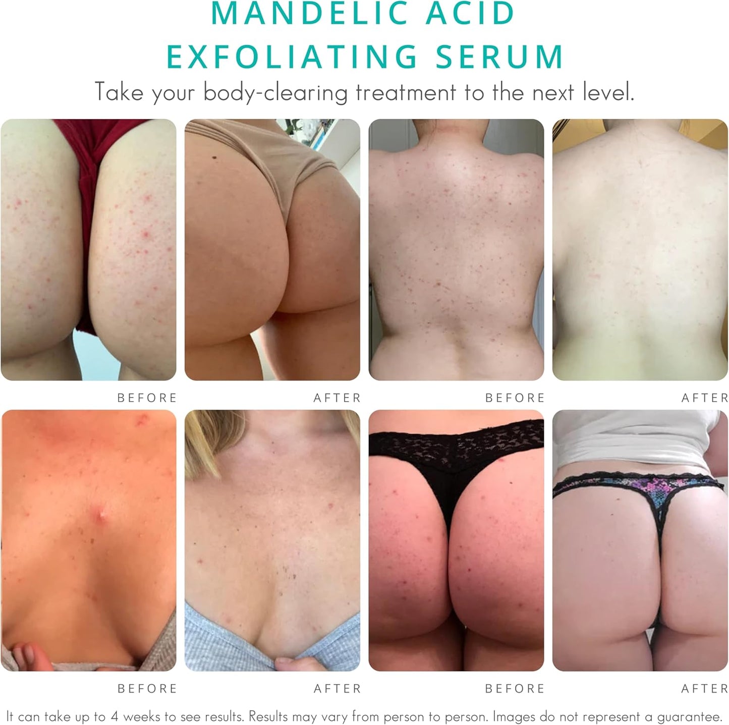 Mandelic Exfoliating Acid Serum